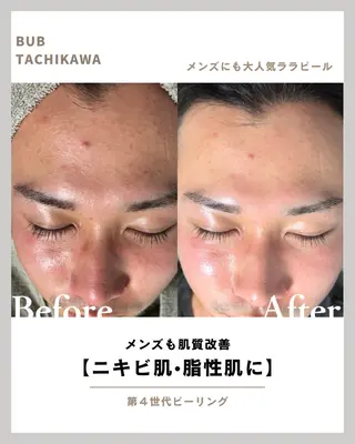 メンズ 【BUB立川】 ゆかのエステ・リラクイメージ