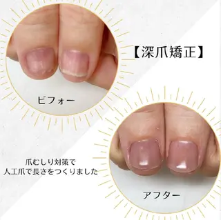 ネイル ネイルサロン アリュームのネイルデザイン
