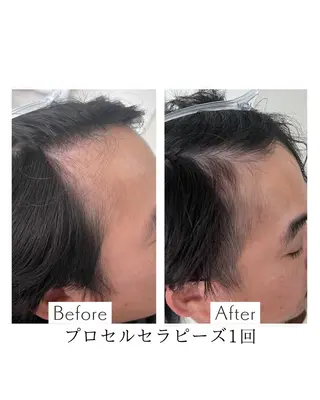 プライベートサロン アオラのネイルデザイン