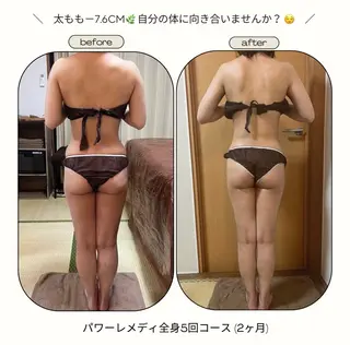 《本気痩せ×疲労改善 》  BILOOPのエステ・リラクイメージ