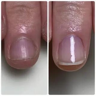ネイル Nail ビ爪のネイルデザイン