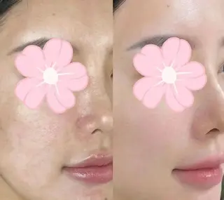 マツエク・マツパ aliaハーブ水光店 エステティシャン募集のエステ・リラクイメージ