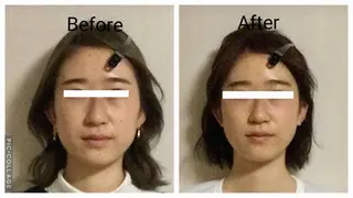 小顔矯正Sho  FaceDesignのエステ・リラクイメージ