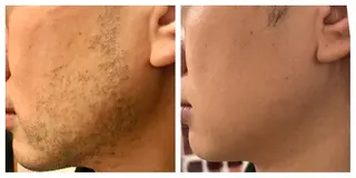 アイブロウ メンズ Renatus 脱毛/美肌/眉/痩身のエステ・リラクイメージ