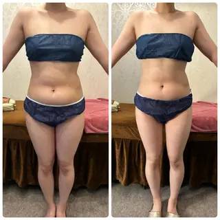 FLEUR 2号店のエステ・リラクイメージ