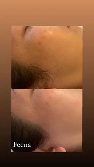 amu nail. RINAのネイルデザイン