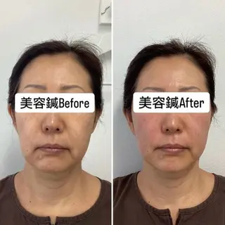 美容鍼灸×小顔整体♡ ハリサロンドオフ堺東のその他イメージ