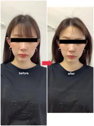 ハリサロンドオフ 美容鍼灸×小顔整体のエステ・リラクイメージ
