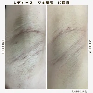 Rappore; 心斎橋 みずきのエステ・リラクイメージ