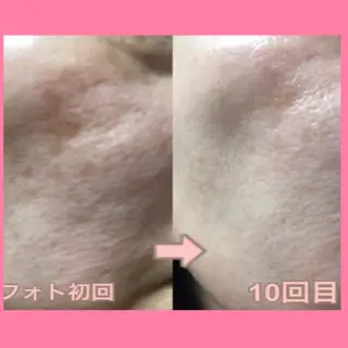 肌ケア&毛穴洗浄 Cheri/女性専用のエステ・リラクイメージ