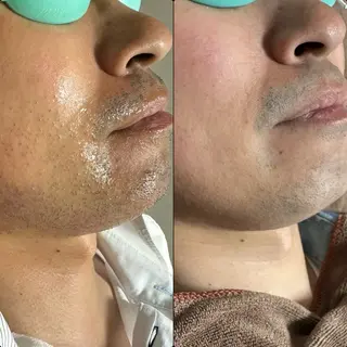 六本木脱毛andS Saoriのエステ・リラクイメージ