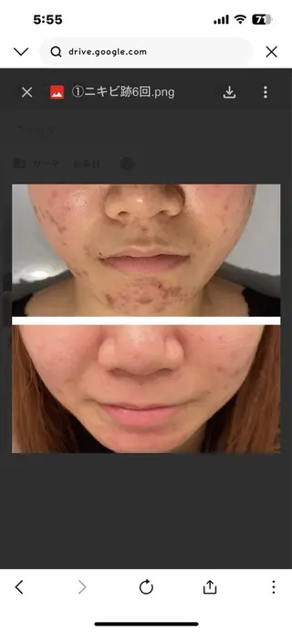 @ MINATOのエステ・リラクイメージ