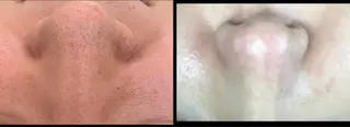 メンズ マツエク・マツパ 大倉 るるなのエステ・リラクイメージ