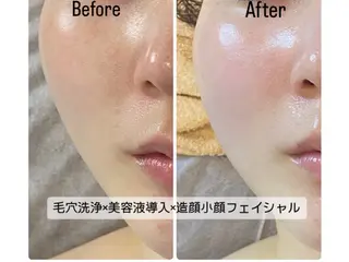 脱毛・エステサロン LuLuNのエステ・リラクイメージ