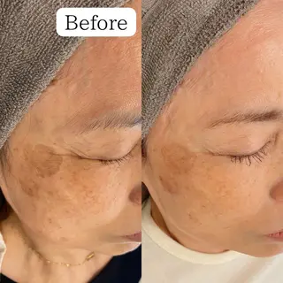 シミケア専門店 &Moreのエステ・リラクイメージ