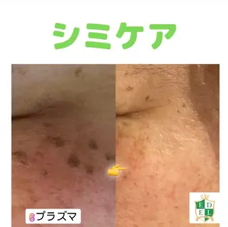 EDEL エーデルのエステ・リラクイメージ