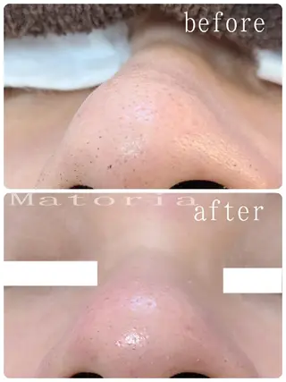 小顔 美肌専門 Matoriaのエステ・リラクイメージ