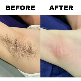 nin feaのエステ・リラクイメージ