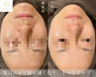 ハーブピーリング専門 グランディール　武内のエステ・リラクイメージ