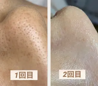 肌改善・リンパサロン CoCoxiaのエステ・リラクイメージ