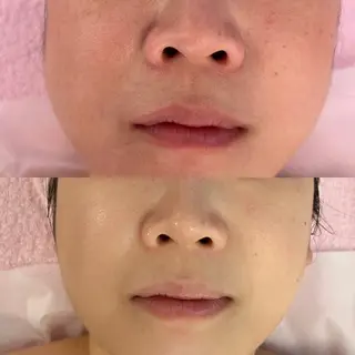 ラ・デエース✨ 肌質改善　中里のエステ・リラクイメージ