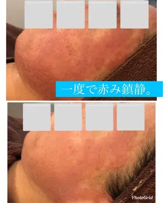 ヘアアレンジ メンズ 金の糸脱毛 産毛ケア専門のエステ・リラクイメージ