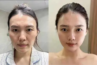 ネイル aliaハーブ水光店 エステティシャン募集のエステ・リラクイメージ