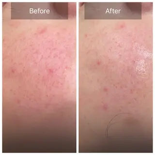 ガレリア エステ 名駅所属・シオダ チコトのエステ・リラクイメージ