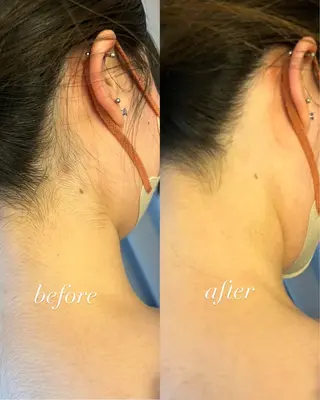 うなじ脱毛/美肌脱毛 LABELのエステ・リラクイメージ