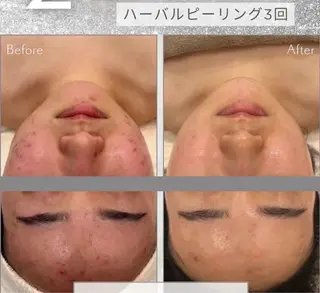 アロマ&アーユルヴェーダサロンParadiso横浜所属・冨菜 みらいのエステ・リラクイメージ