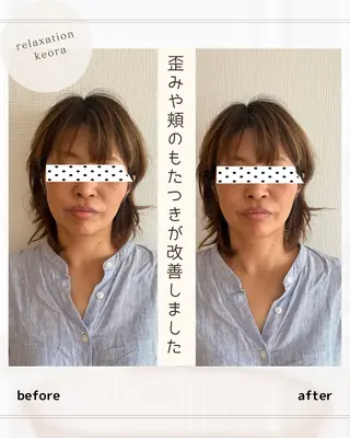 小顔矯正& 慢性肩こり腰痛改善店のエステ・リラクイメージ