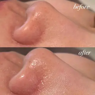 エスティシャン なこのエステ・リラクイメージ