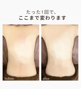 35歳からの エイジングケアサロンのエステ・リラクイメージ