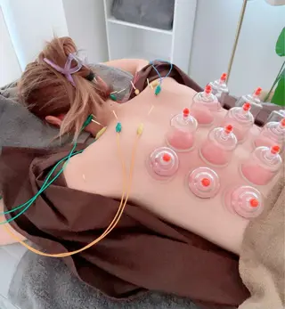 鍼グリッター 仁科陽花のエステ・リラクイメージ