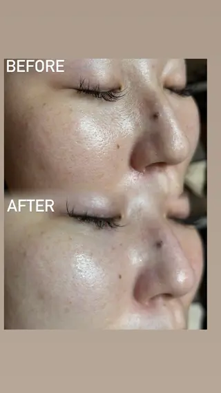 刀根 ひなたの眉毛・アイブロウイメージ