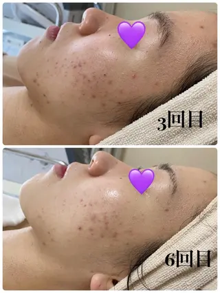 COCO beautyサロンのエステ・リラクイメージ