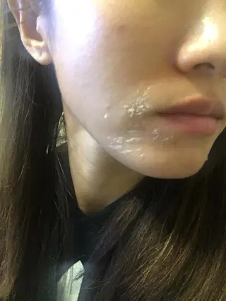 Momo Eggsのエステ・リラクイメージ