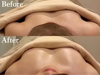 LOAバストア専門店 LOAのエステ・リラクイメージ