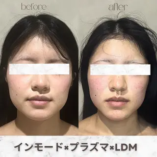 aimer 服部のその他イメージ