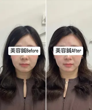 美容鍼灸×小顔整体♡ ハリサロンドオフ堺東のその他イメージ