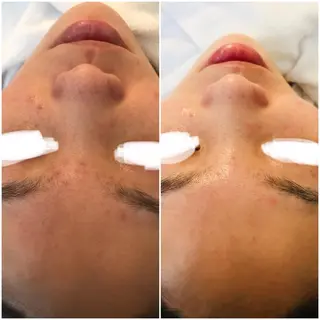 aliaハーブ水光店 エステティシャン募集のエステ・リラクイメージ