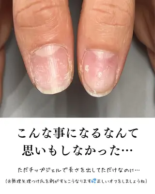 ネイル Aim* 深爪自爪育成専門店のネイルデザイン