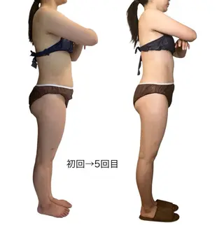 ラジオ波×リリース リラク★痩身MISAのエステ・リラクイメージ