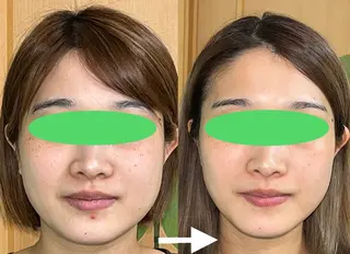 春日井トータルからだ サロンふくふくのエステ・リラクイメージ