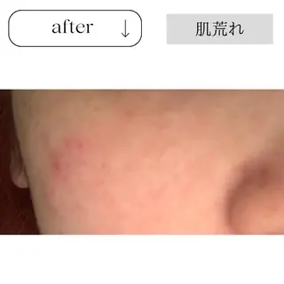 beauty CHOOSEのエステ・リラクイメージ