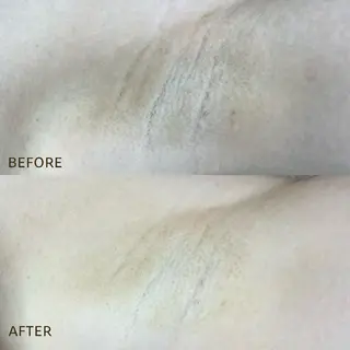 毛穴/肌管理/痩身/ ボディケア/satoのエステ・リラクイメージ