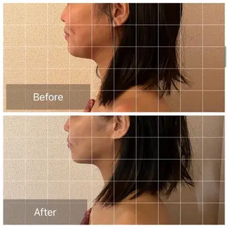 表情筋フェイシャル 三軒茶屋のエステ・リラクイメージ