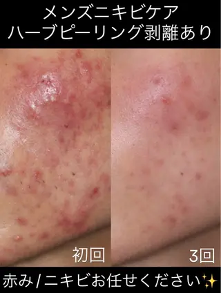 Soin所属・Soin 身体＆お肌ケアのエステ・リラクイメージ