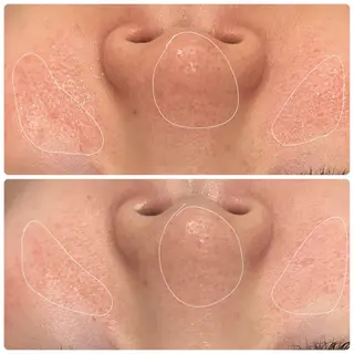 メナード片町 やまもと みくのエステ・リラクイメージ