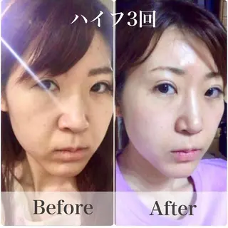 綺麗のひみつ グランプリ受賞店のエステ・リラクイメージ